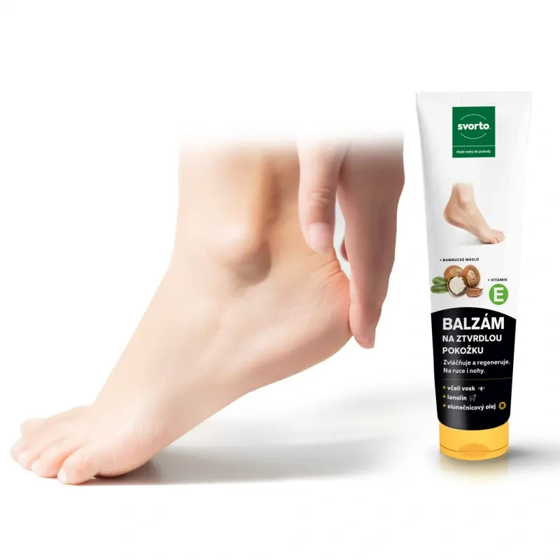 303 Balzám na ztvrdlou pokožku 100 ml